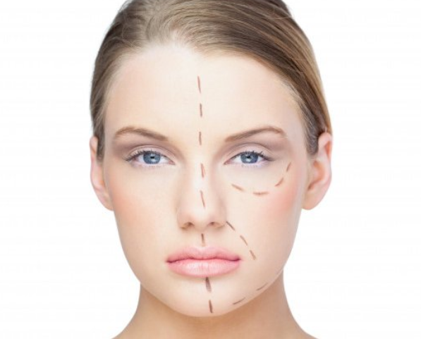 Asimetria facial 2