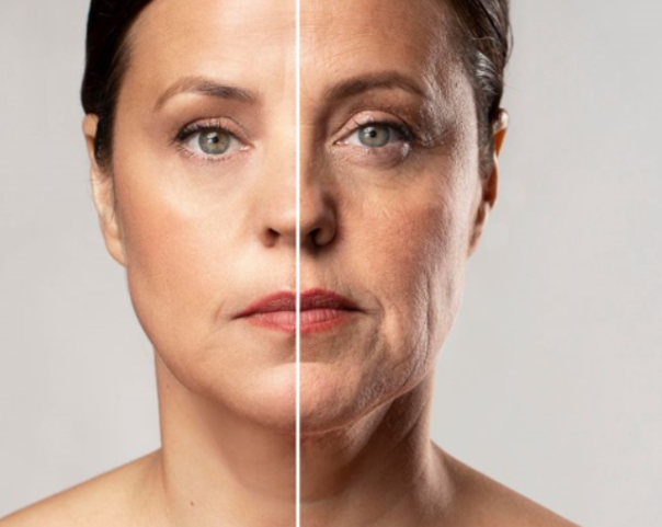 fLACIDEZ FACIAL 2