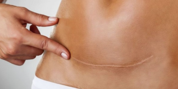Cirugía abdominal